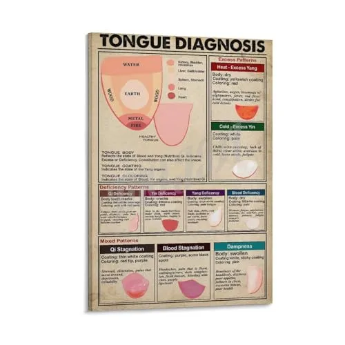 Retro Traditional Chinese Medicine Tongue Diagnostic Poster - 08x12 Inch Acupuncture Wall Art